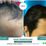 Before After Image of our Patients