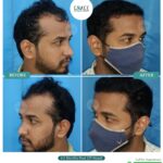 Before After Image of our Patients