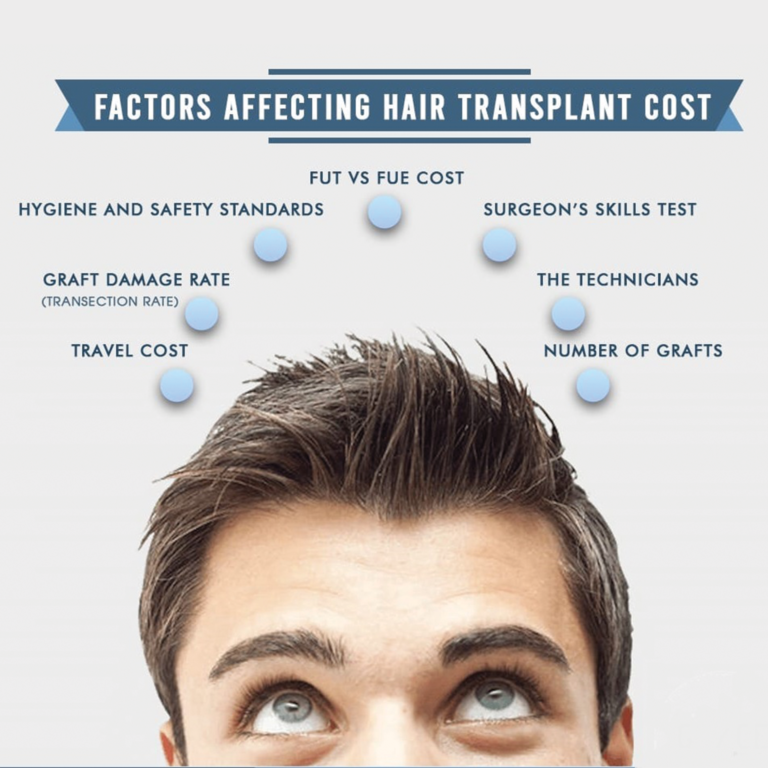 Top 5 factors affecting hair transplant cost