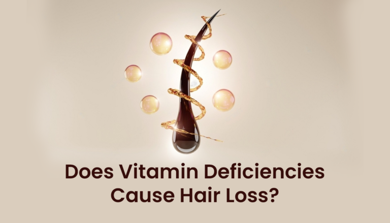 Does Vitamin Deficiencies Cause Hair Loss?