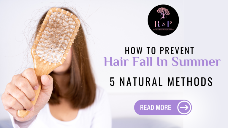 How To Prevent Hair Fall In Summer – 5 Natural Methods
