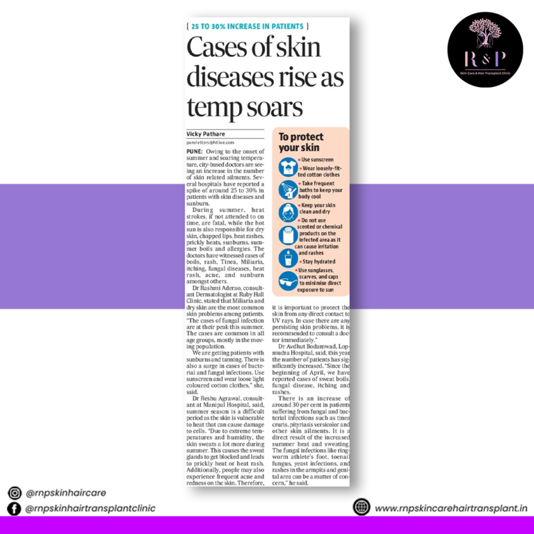 Cases of skin diseases rise as temperature soars.