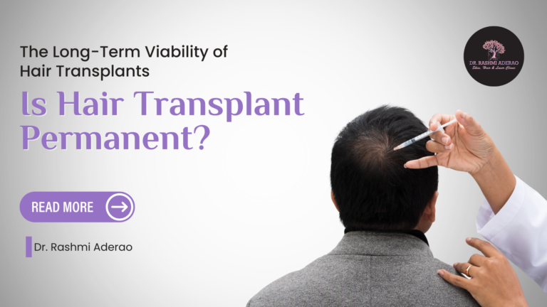 The Long-Term Viability of Hair Transplants: Is Hair Transplant Permanent?