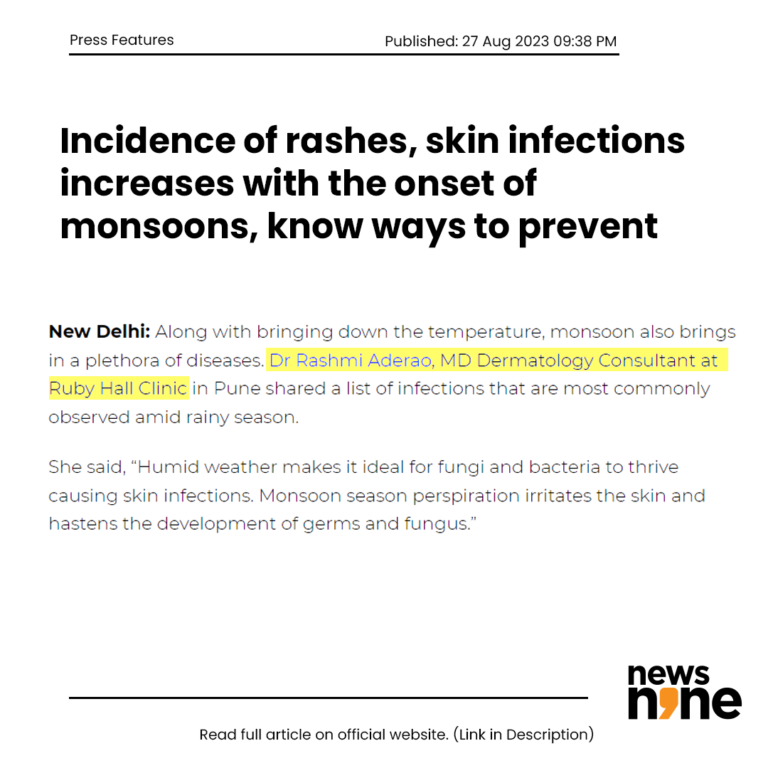 Incidence of rashes, skin infections increases with the onset of monsoons, know ways to prevent