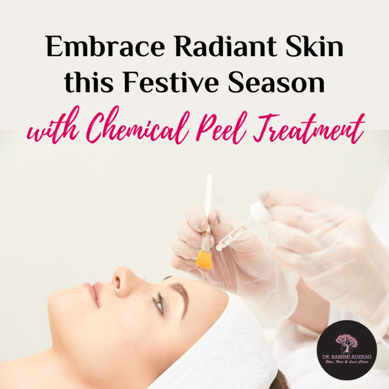 Embrace Radiant Skin this Festive Season with Chemical Peel Treatment