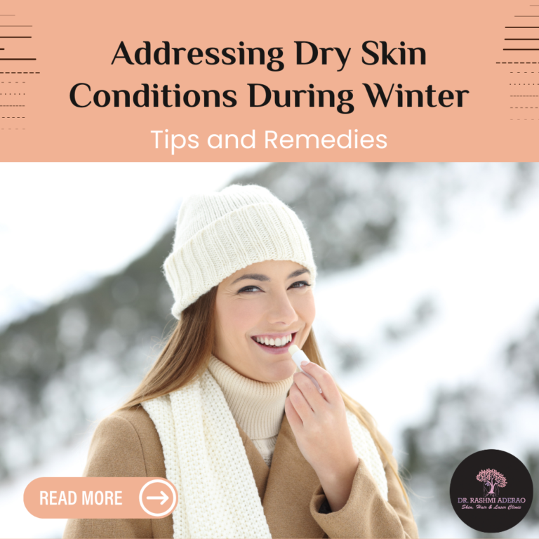 Addressing Dry Skin Conditions During Winter: Tips and Remedies