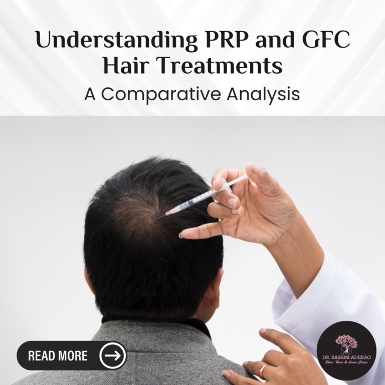 Understanding PRP and GFC Hair Treatments: A Comparative Analysis