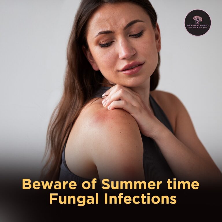 Beware of Summertime Fungal Infections