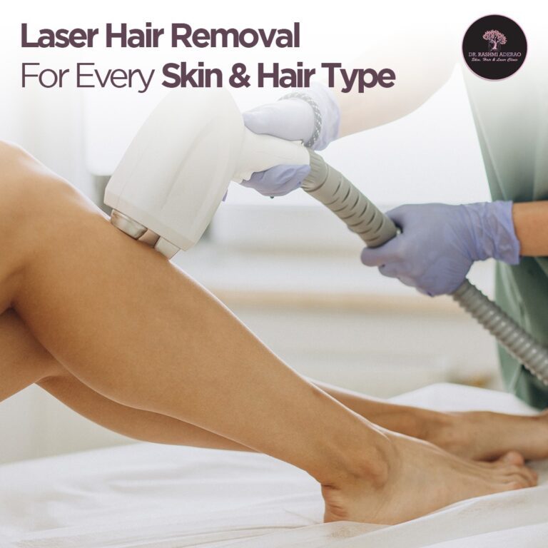 Laser Hair Removal for Every Skin and Hair Type