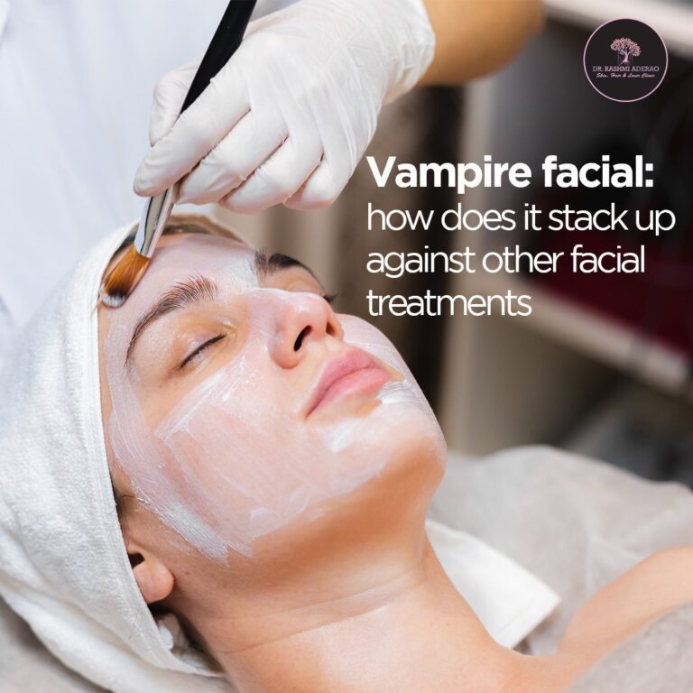 Vampire Facial: How Does It Stack Up Against Other Facial Treatments?