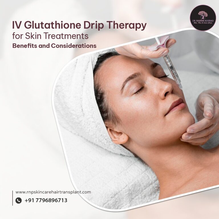 IV Glutathione Drip Therapy for Skin Treatments: Benefits and Considerations