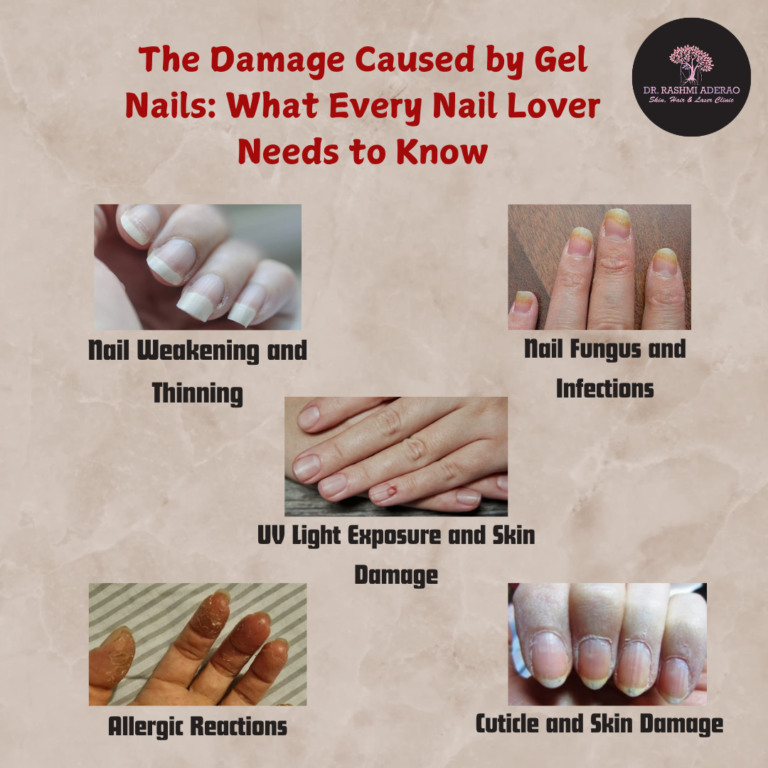 The Damage Caused by Gel Nails: What Every Nail Lover Needs to Know